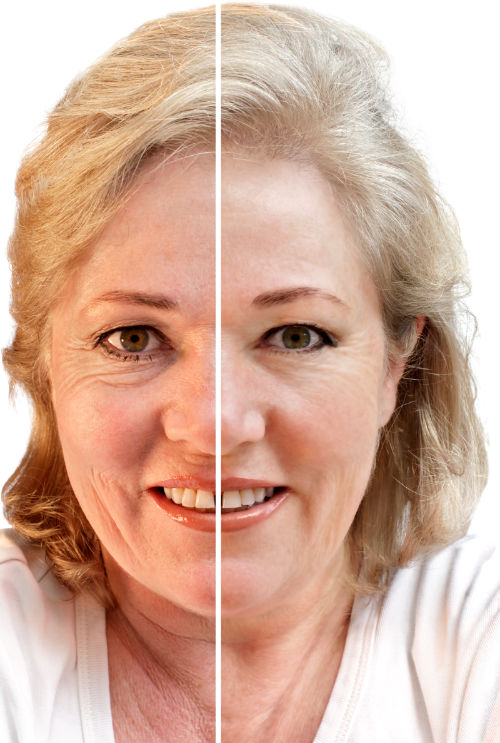 Searching for Anti-Aging Treatments in Westfield