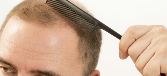 Significance Of Hair Loss Treatments For Individuals In Philadelphia, PA