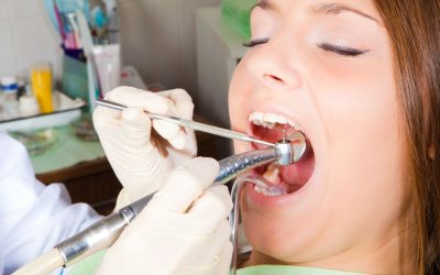 Go to a Dental Clinic That Offers The Best Root Canal Therapy in Vista, CA